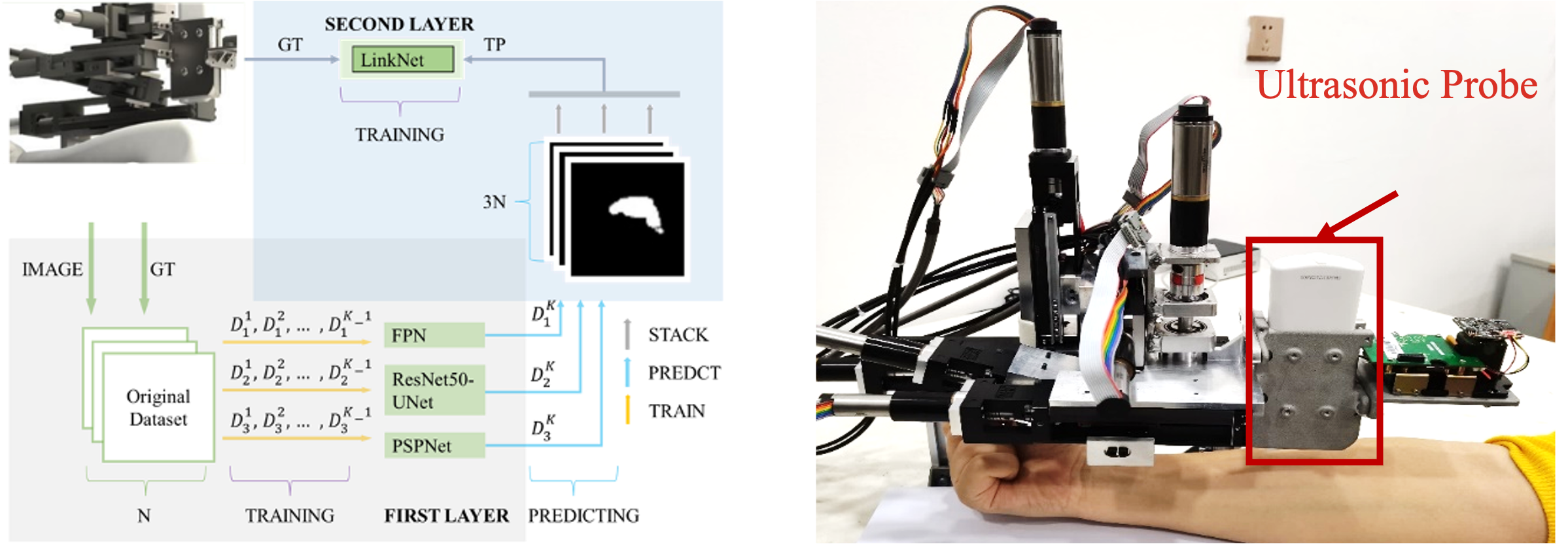 Ultrasound Method - ISM