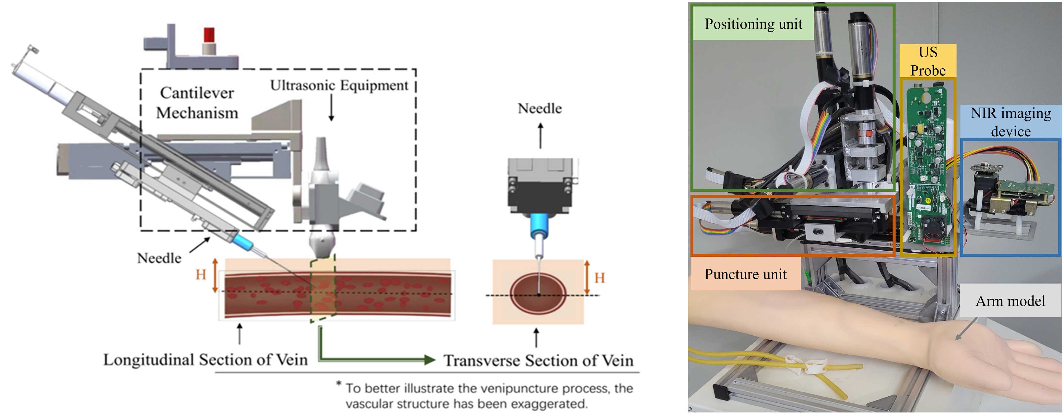 Vein Puncture