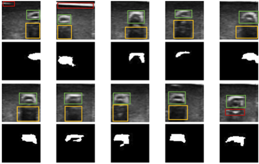 Ultrasound Results